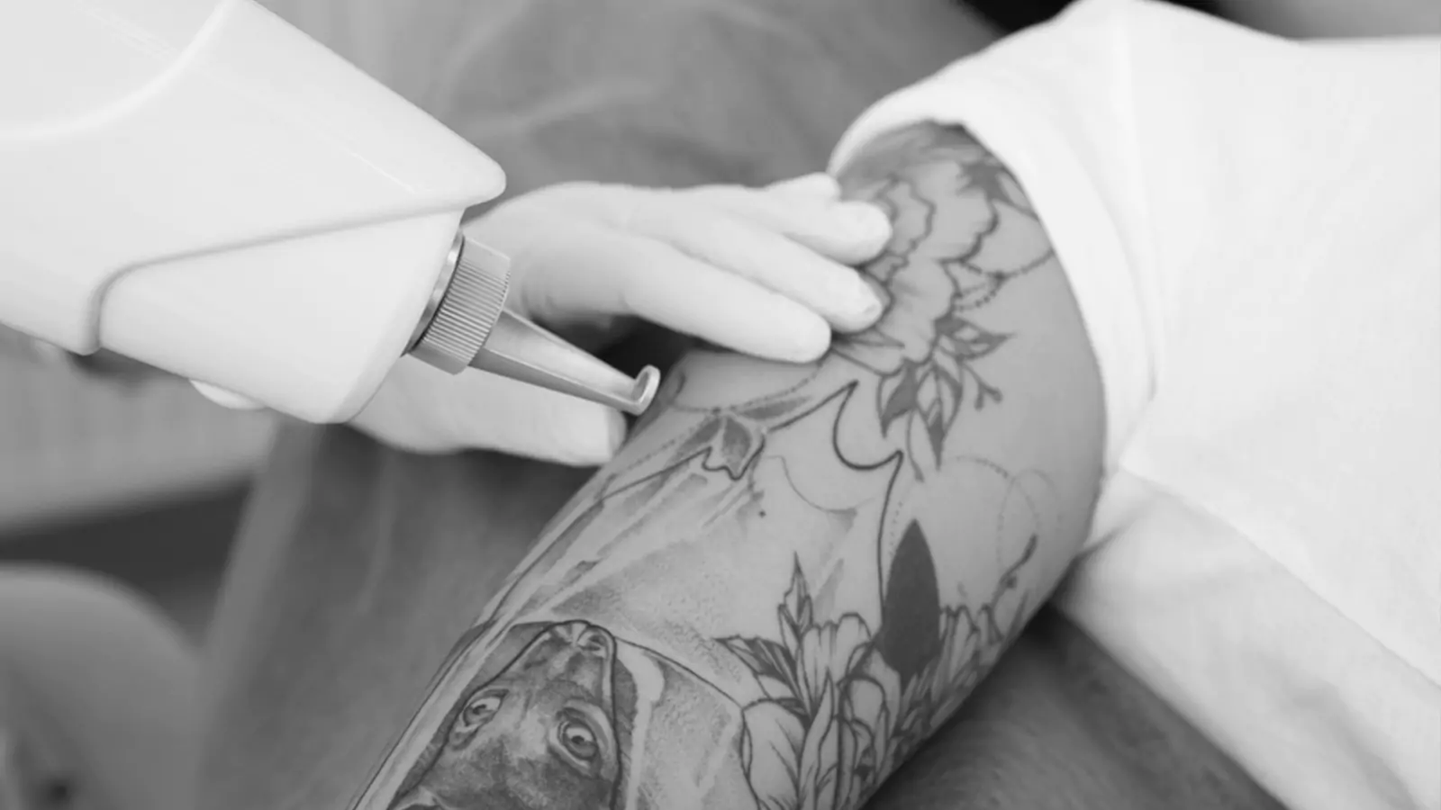 Tattoo removing serice